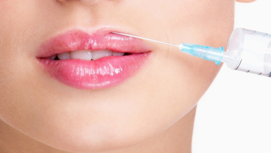 Kolagen Povećanje usana Estetska hirurgija