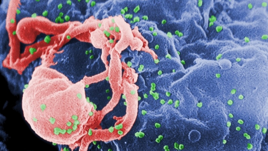 Milioni širom sveta se bore sa HIV-om