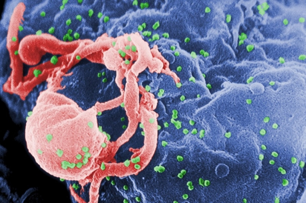 Milioni širom sveta se bore sa HIV-om