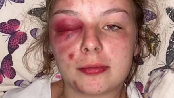 "PRONAŠLI SMO ČEKIĆ!" Optužila je trojicu za silovanje, objavila povrede na Fejsbuku, a onda je došlo do neviđenog obrta!