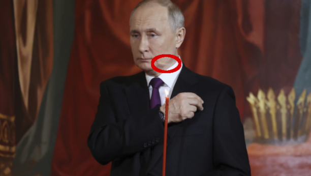 "ČUDAN OŽILJAK NA VRATU" Nove spekulacije o Putinovom zdravlju: Teško se kretao, ne izgleda dobro (FOTO)