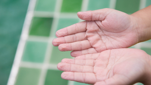 Sigurno ste se zapitali: Zašto su prsti smežurani posle dugo vremena u vodi?