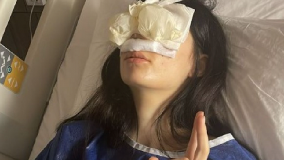 ŠOKIRALA FANOVE  Uki Ku objavila fotografije iz bolničkog kreveta, za novi nos je iskeširala 7.000 evra, a sada je progovorila o operaciji grudi: Imam ožilke!